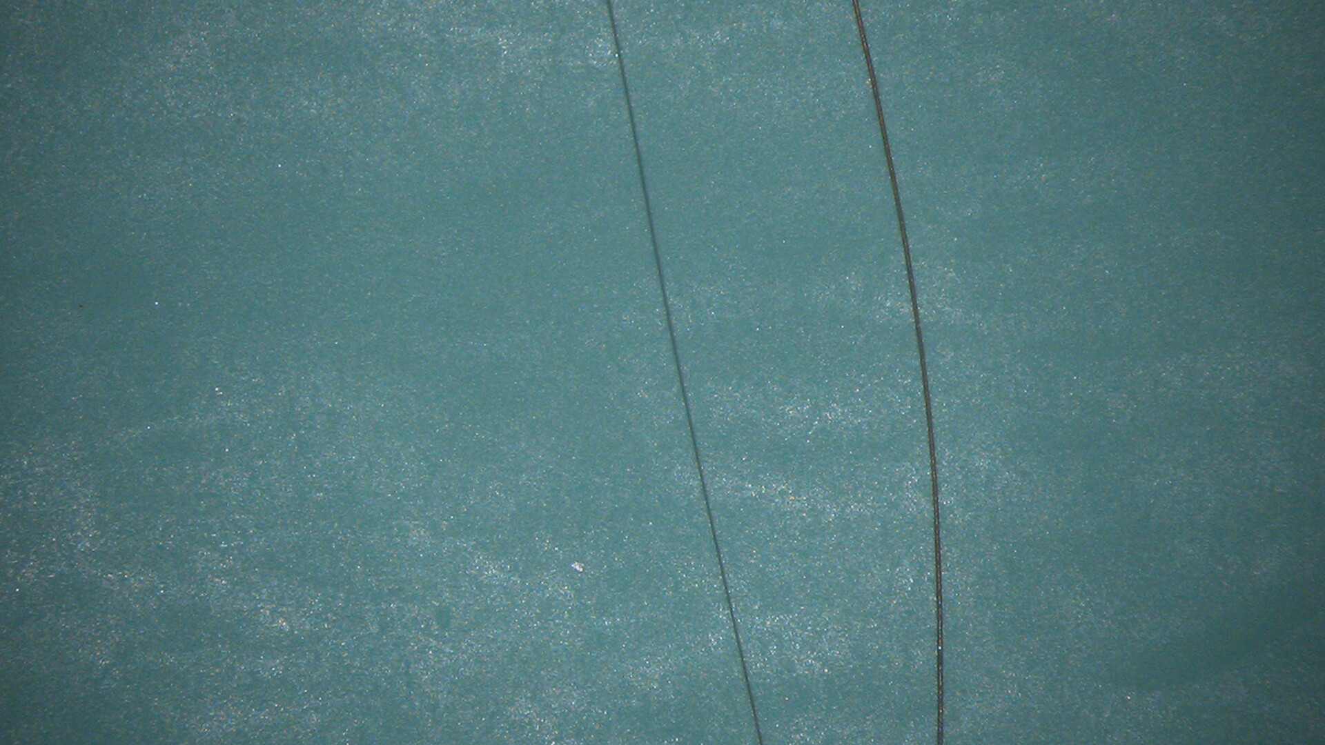 Нить для хирургии (слева) в сравнении с человеческим волосом (справа)